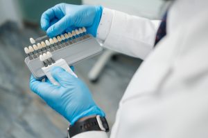 dentist comparing veneer colors