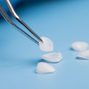 porcelain veneers