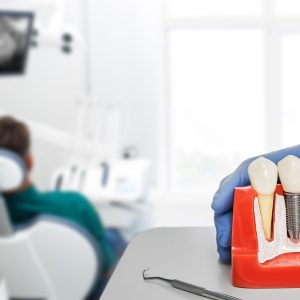plastic model of a dental implant
